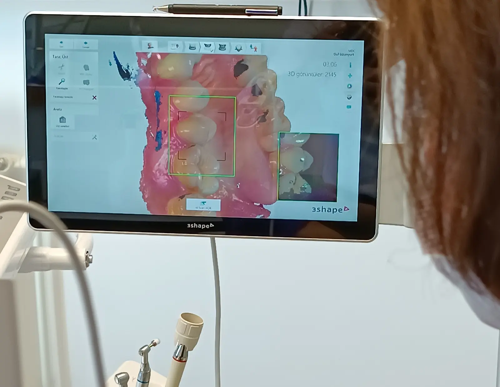Clinic-provided photograph of Manavgatdent Dental Clinic