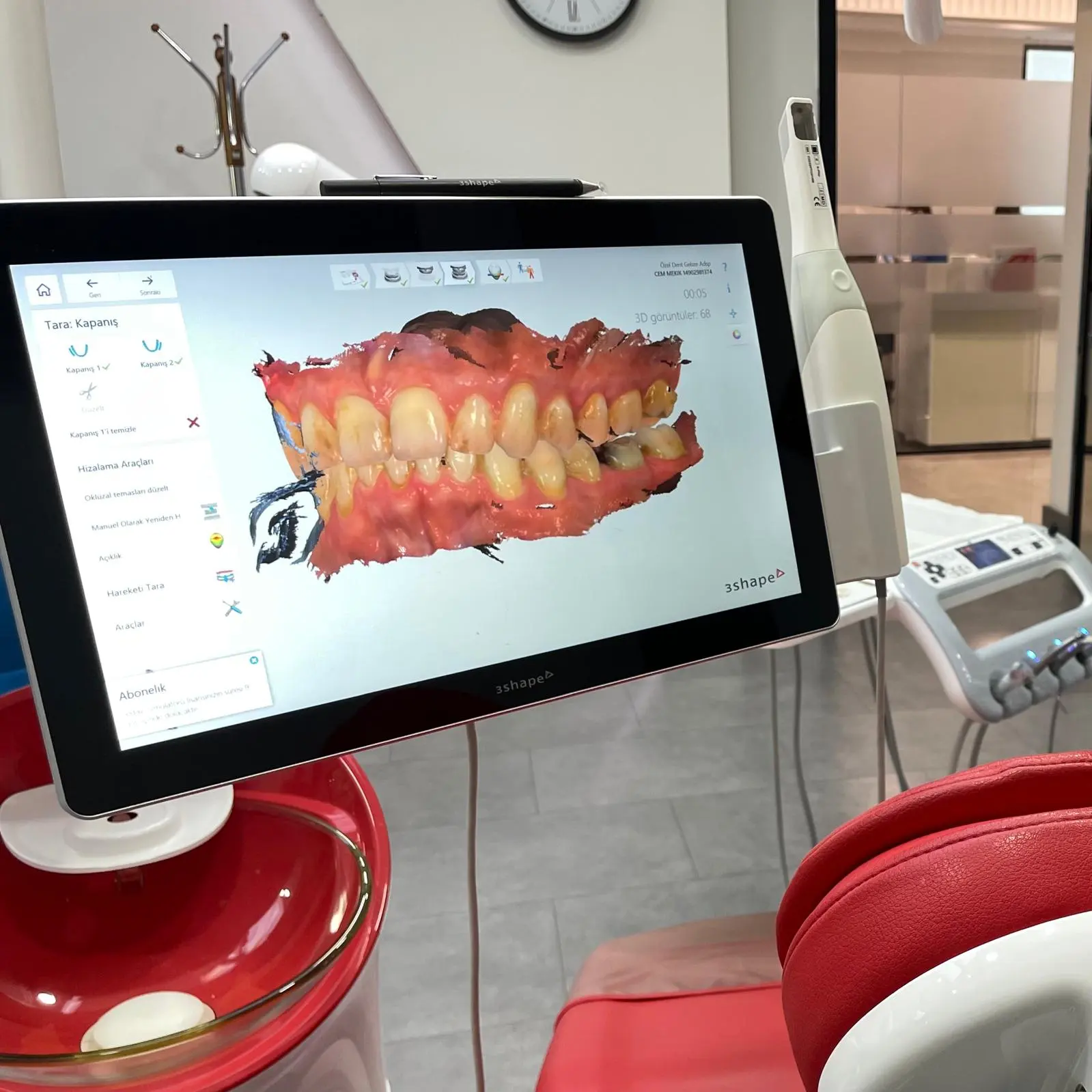 Clinic-provided photograph of Dent Gebze