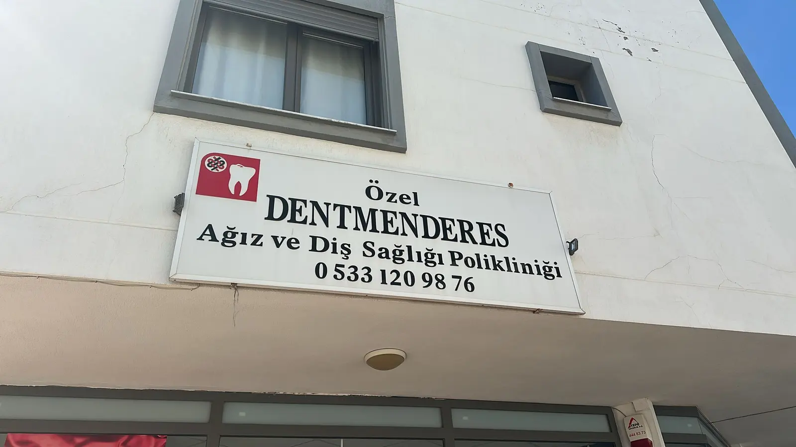 Clinic-provided photograph of Dent Menderes